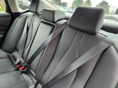 2025 Acura TLX Technology Package