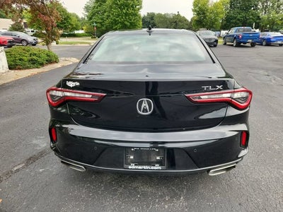 2025 Acura TLX Technology Package