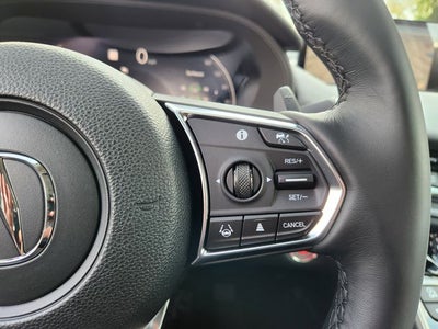 2025 Acura TLX Technology Package